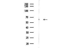 anti-Glucose-6-Phosphate Isomerase (GPI) (C-Term) antibody