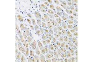 Immunohistochemistry of paraffin-embedded mouse stomach using IFNL1 antibody at dilution of 1:100 (40x lens). (IL29 anticorps)