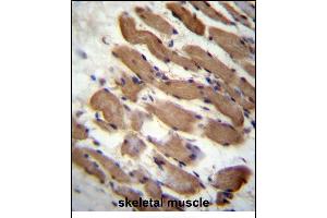 LMD Antibody (N-term) (ABIN657125 and ABIN2846269) immunohistochemistry analysis in formalin fixed and raffin embedded human skeletal muscle followed by peroxidase conjugation of the secondary antibody and DAB staining.