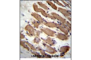 LMD Antibody (N-term) (ABIN657125 and ABIN2846269) immunohistochemistry analysis in formalin fixed and raffin embedded human skeletal muscle followed by peroxidase conjugation of the secondary antibody and DAB staining. (PALMD anticorps  (N-Term))
