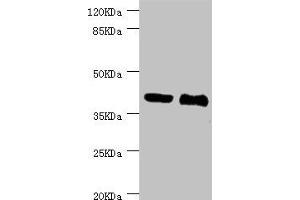 Western blot All lanes: NHLRC1 antibody at 3. (NHLRC1 anticorps  (AA 1-280))