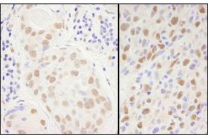 Immunohistochemistry (IHC) image for anti-Sp1 Transcription Factor (SP1) (AA 700-740) antibody (ABIN7454591) (SP1 anticorps  (AA 700-740))