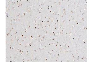 ABIN6267524 at 1/200 staining Rat heart tissue sections by IHC-P.