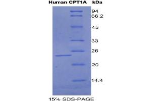 SDS-PAGE analysis of Human CPT1A Protein. (CPT1A Protéine)