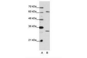 Image no. 2 for anti-AU RNA Binding Protein/enoyl-CoA Hydratase (AUH) (AA 228-277) antibody (ABIN6736199)