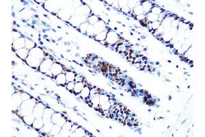 Immunohistochemistry of paraffin-embedded human colon using MCM5 Rabbit mAb (ABIN7268543) at dilution of 1:100 (40x lens). (MCM5 anticorps)