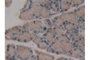 Detection of LEI in Rat Pancreas Tissue using Polyclonal Antibody to Leukocyte Elastase Inhibitor (LEI)