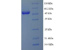 SDS-PAGE (SDS) image for Unc-51 Like Kinase 1 (ULK1) (AA 11-312) protein (His-SUMO Tag) (ABIN5711431)