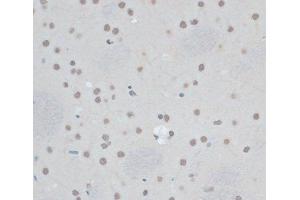 Immunohistochemistry of paraffin-embedded Rat brain using ZNF433 Polyclonal Antibody at dilution of 1:100 (40x lens). (ZNF433 anticorps)