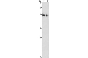Western Blotting (WB) image for anti-Angiopoietin 4 (ANGPT4) antibody (ABIN2432479) (Angiopoietin 4 anticorps)
