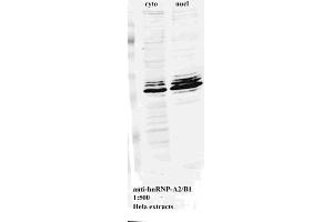 Western blot for Anti-hnRNP-A2/B1 on HeLa cell extract (HNRNPA2B1 anticorps)