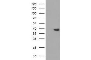 Western Blotting (WB) image for anti-3-hydroxyisobutyryl-CoA Hydrolase (HIBCH) antibody (ABIN1498654)