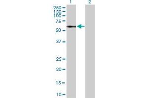 Western Blot analysis of IL13RA1 expression in transfected 293T cell line by IL13RA1 MaxPab polyclonal antibody.