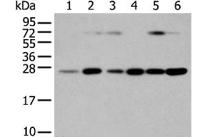 Western Blot analysis of Human placenta tissue and hela cell, hepg2 cell and Human fetal liver tissue, A549 cell and Human normal kidney tissue using SNAP23 Polyclonal Antibody at dilution of 1:400 (SNAP23 anticorps)