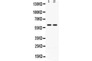 Western blot analysis of CCT3 using anti- CCT3 antibody . (CCT3 anticorps  (C-Term))