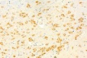 Immunohistochemistry analysis of paraffin-embedded mouse brain using,KPNB1 (ABIN7074398) at dilution of 1: 1000 (KPNB1 anticorps)