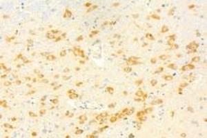 Immunohistochemistry analysis of paraffin-embedded mouse brain using,KPNB1 (ABIN7074398) at dilution of 1: 1000 (KPNB1 anticorps)
