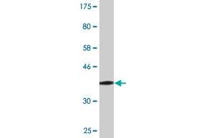 Western Blot detection against Immunogen (37.