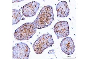 IHC analysis of Epigen using anti-Epigen antibody (ABIN5518911). (Epigen anticorps  (AA 19-109))