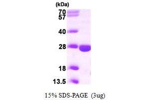 SDS-PAGE (SDS) image for phosphopantothenoylcysteine Decarboxylase (PPCDC) (AA 1-204) protein (His tag) (ABIN667238)