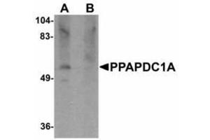 Image no. 1 for anti-Phosphatidic Acid Phosphatase Type 2 Domain Containing 1A (PPAPDC1A) (C-Term) antibody (ABIN478207) (PPAPDC1A anticorps  (C-Term))