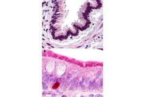 Immunohistochemical staining of formalin-fixed paraffin-embedded human lung, respiratory epithelium (A) and human small intestine (B) with C3AR1 polyclonal antibody . (C3AR1 anticorps  (Extracellular Domain))