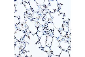 Immunohistochemistry of paraffin-embedded mouse lung using Twist Rabbit pAb (ABIN6133951, ABIN6149713, ABIN6149716 and ABIN6220170) at dilution of 1:200 (40x lens).