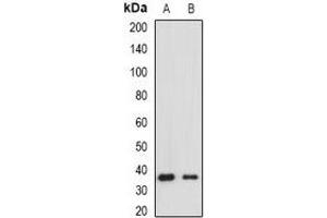 Western blot analysis of HLA-DRA expression in Raji (A), Jurkat (B) whole cell lysates. (HLA-DRA anticorps)