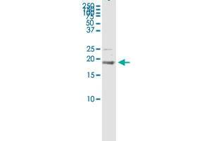 BST2 (Human) IP-WB Antibody Pair
