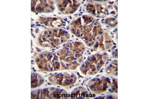 Immunohistochemistry (IHC) image for anti-Growth Differentiation Factor 5 (GDF5) antibody (ABIN2996505) (GDF5 anticorps)