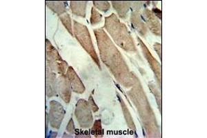 Formalin-fixed and paraffin-embedded human skeletal muscle reacted with the primary antibody, which was peroxidase-conjugated to the secondary antibody, followed by AEC staining.