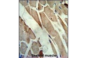 Formalin-fixed and paraffin-embedded human skeletal muscle reacted with the primary antibody, which was peroxidase-conjugated to the secondary antibody, followed by AEC staining. (CKM anticorps  (C-Term))