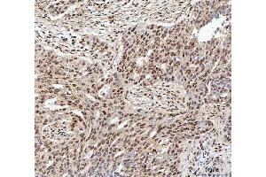 IHC analysis of SDE2 using anti-SDE2 antibody (ABIN7599603). (C1orf55 anticorps  (AA 10-447))