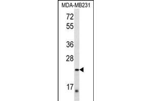 PEX11A Antibody (Center) (ABIN657084 and ABIN2837890) western blot analysis in MDA-M cell line lysates (35 μg/lane). (PEX11A anticorps  (AA 137-165))