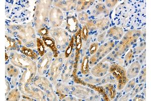 ABIN6259232 and ABIN6275659 at 1/100 staining Rat kidney tissue by IHC-P. (USP45 anticorps  (Internal Region))