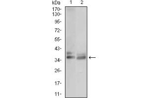 Western blot analysis using ACP5 antibody against JURKAT (1) and OCM-1 (2) cell lysate.