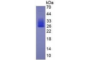 Image no. 1 for Interleukin 6 (IL6) (AA 25-211) (Active) protein (His tag) (ABIN6239753) (IL-6 Protein (AA 25-211) (His tag))