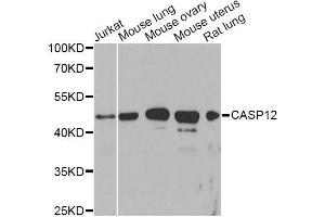Western blot analysis of extracts of various cell lines, using CASP12 Antibody. (Caspase 12 anticorps)