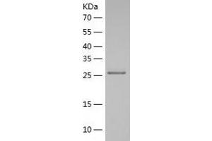Western Blotting (WB) image for Polyglutamine Binding Protein 1 (PQBP1) (AA 1-265) protein (His-IF2DI Tag) (ABIN7124510)