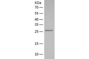 Western Blotting (WB) image for Polyglutamine Binding Protein 1 (PQBP1) (AA 1-265) protein (His tag) (ABIN7124510) (PQBP1 Protein (AA 1-265) (His tag))