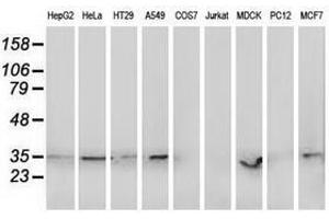 Image no. 2 for anti-Retinol Dehydrogenase 14 (All-Trans/9-Cis/11-Cis) (RDH14) antibody (ABIN1500657) (RDH14 anticorps)