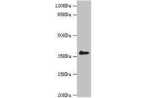 Western blot All lanes: LIMS1 antibody at 0.