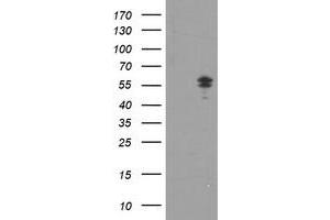 HEK293T cells were transfected with the pCMV6-ENTRY control (Left lane) or pCMV6-ENTRY NONO (Right lane) cDNA for 48 hrs and lysed. (NONO anticorps  (AA 184-385))