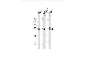 All lanes : Anti-KDELR1 Antibody (C-term) at 1:2000 dilution Lane 1: Hela whole cell lysate Lane 2: MCF-7 whole cell lysate Lane 3: 293 whole cell lysate Lysates/proteins at 20 μg per lane. (KDELR (AA 185-211), (C-Term) anticorps)
