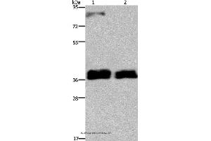 Western blot analysis of 231 and A172 cell, using FETUB Polyclonal Antibody at dilution of 1:700
