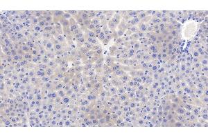 Detection of ITGb1 in Mouse Liver Tissue using Polyclonal Antibody to Integrin Beta 1 (ITGb1)