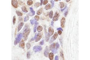 Immunohistochemistry (IHC) image for anti-CoaA (AA 150-200) antibody (ABIN7448480) (CoaA (AA 150-200) anticorps)