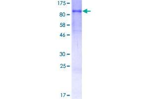 Image no. 1 for Matrix Metallopeptidase 9 (Gelatinase B, 92kDa Gelatinase, 92kDa Type IV Collagenase) (MMP9) (AA 1-707) protein (GST tag) (ABIN1311093)