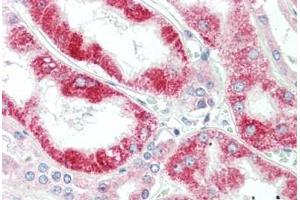 Human Kidney: Formalin-Fixed, Paraffin-Embedded (FFPE)