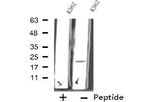 Western blot analysis of extracts from K562 cells using RPL11 antibody. (RPL11 anticorps  (C-Term))